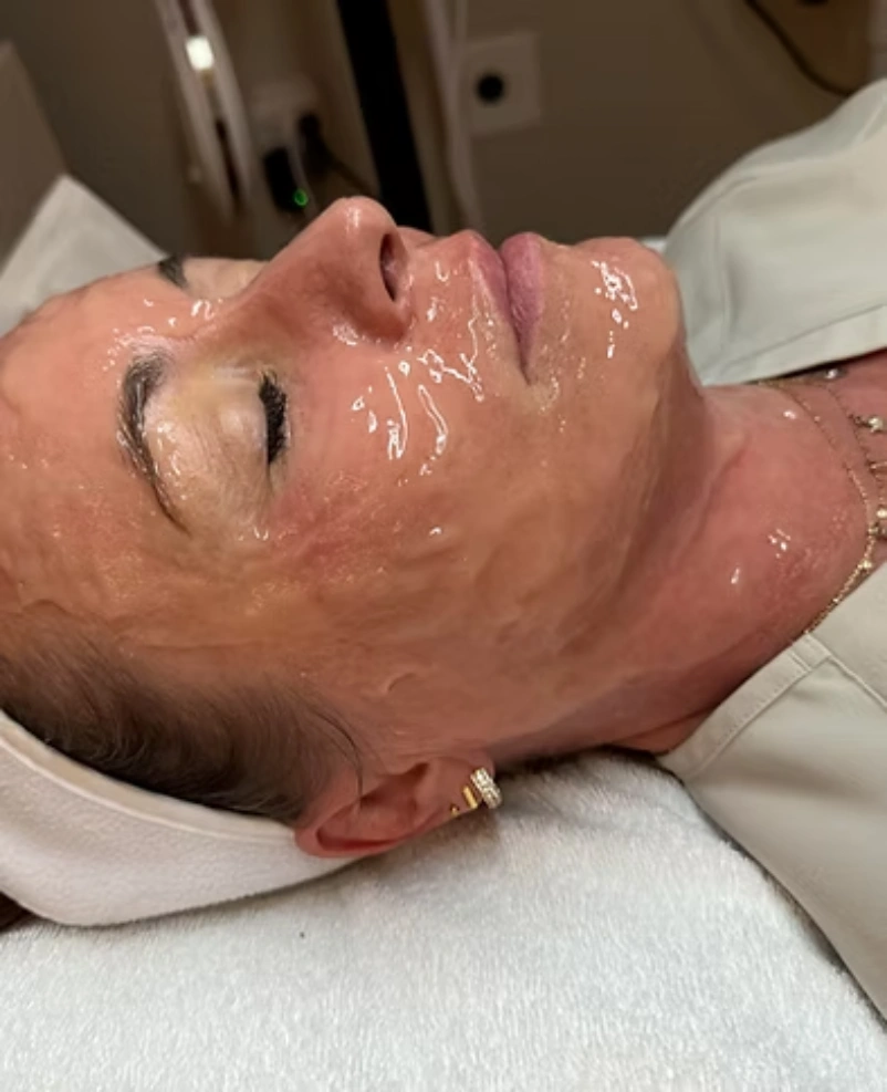 Carboxy Facial with PDRN in Cedar Park, TX at C2 Aesthetic