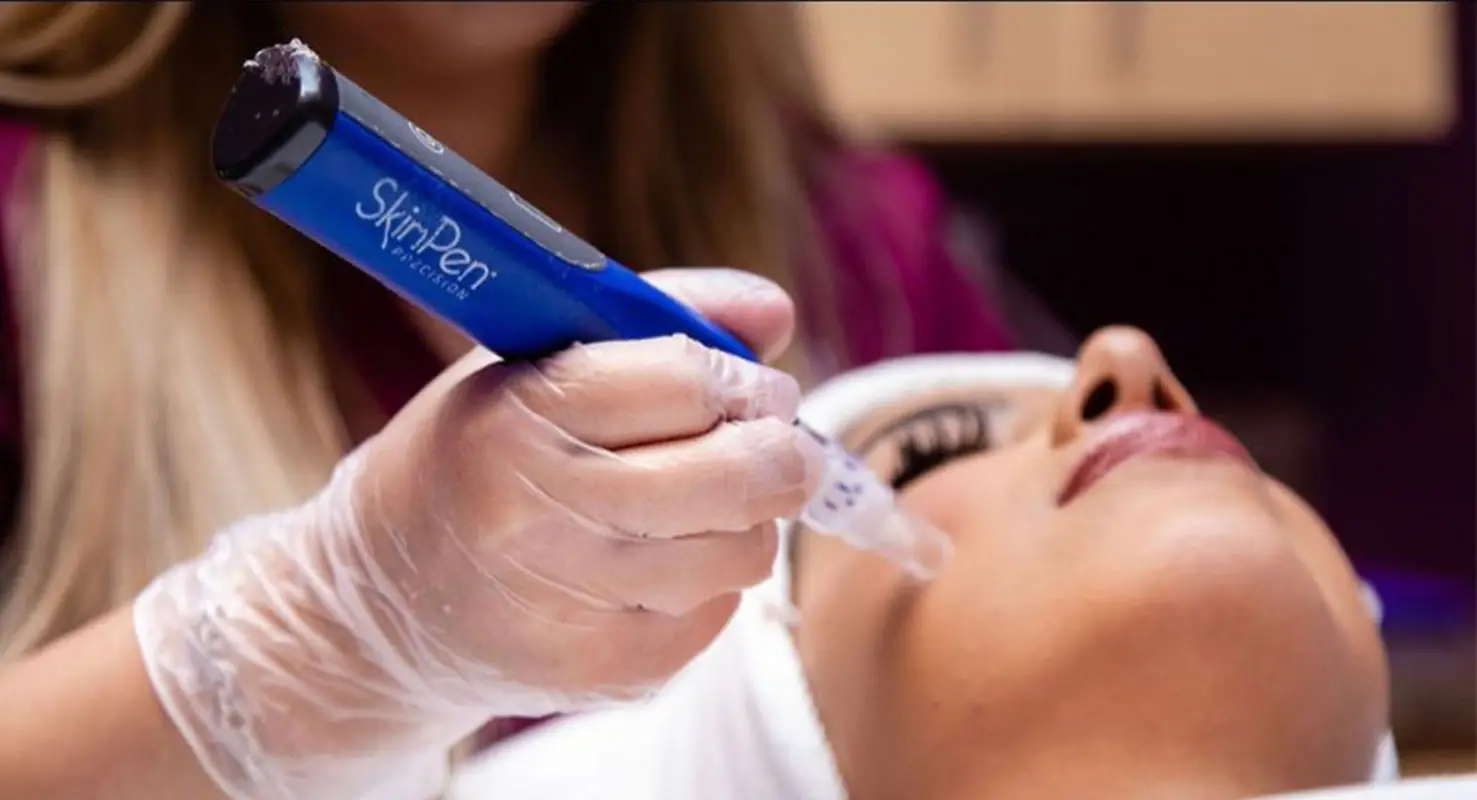 C2 Aesthetics Skin Pen Microneedling with Regenerative Complex in Cedar Park, TX