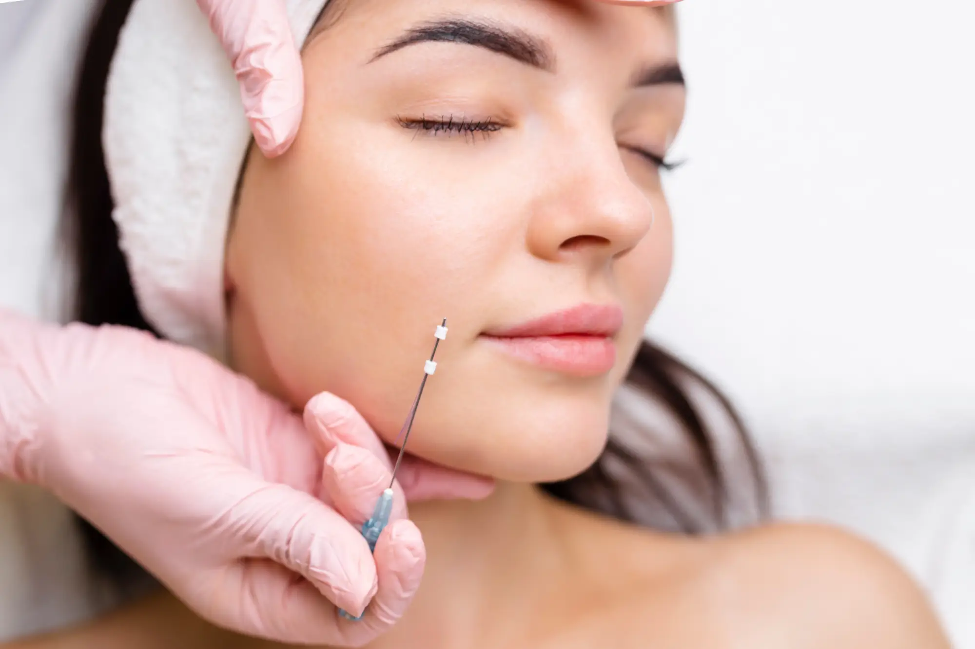 C2 Aesthetics PDO Smooth Threads in Cedar Park, TX