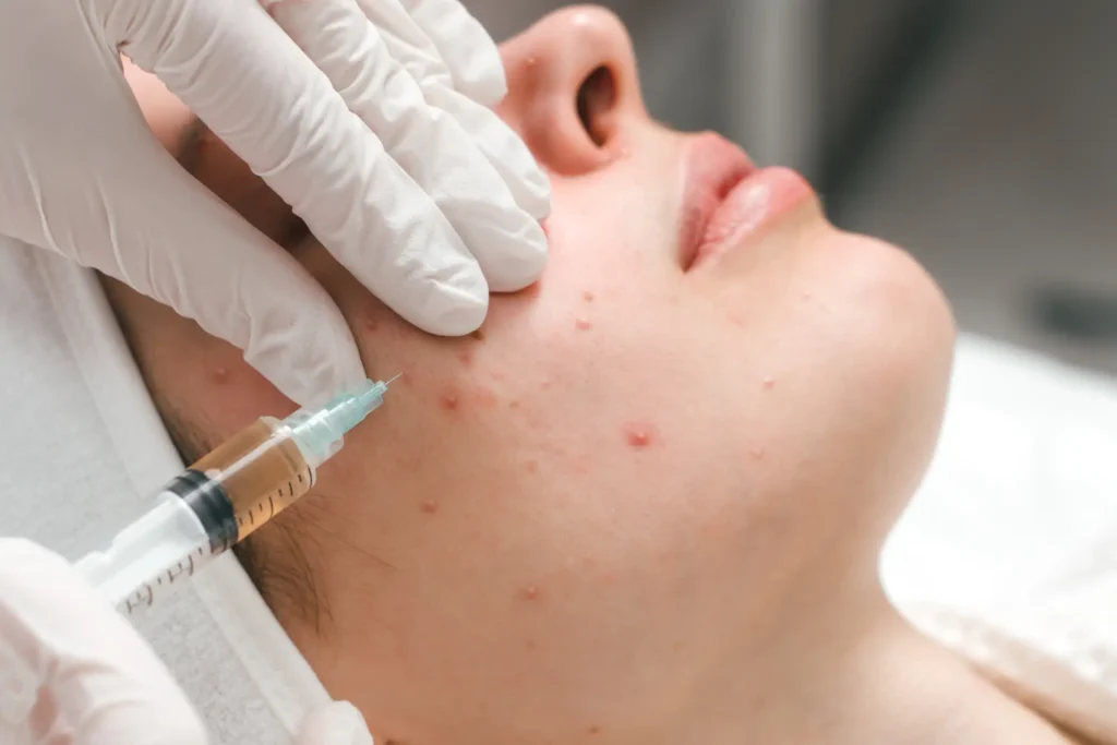 C2 Aesthetics Acne Injections in Cedar Park, TX