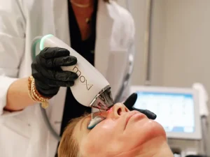 C2 Aesthetics Moxi Laser in Cedar Park, TX
