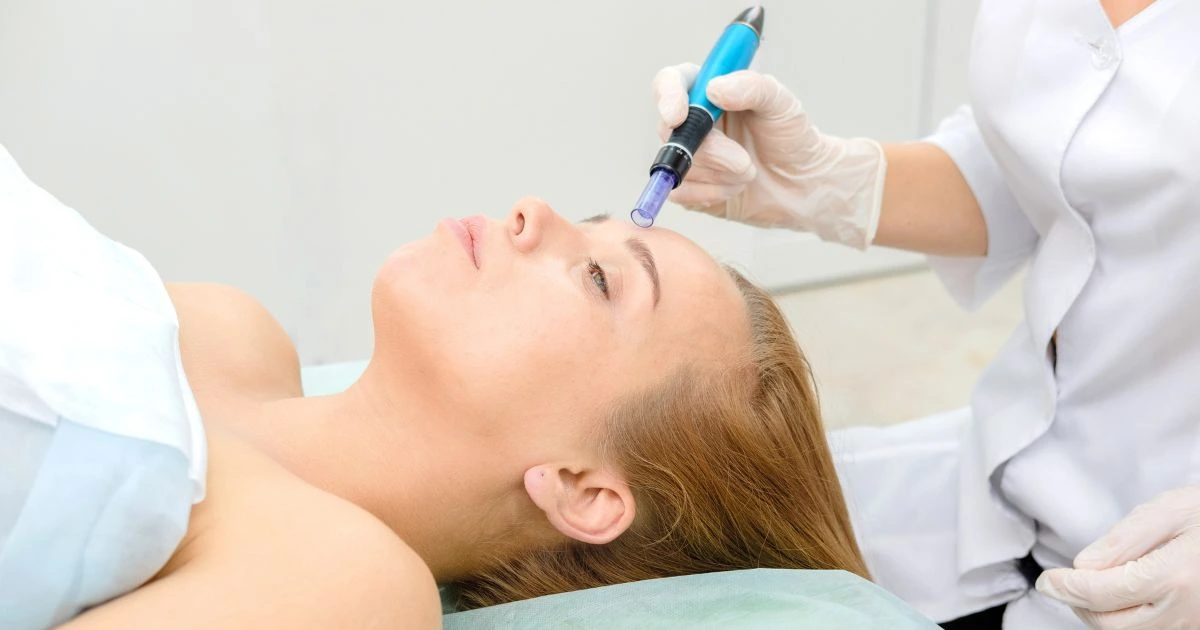 The Virtue RF Microneedling system featuring gold-coated needles at C2 Aesthetics Med Spa.
